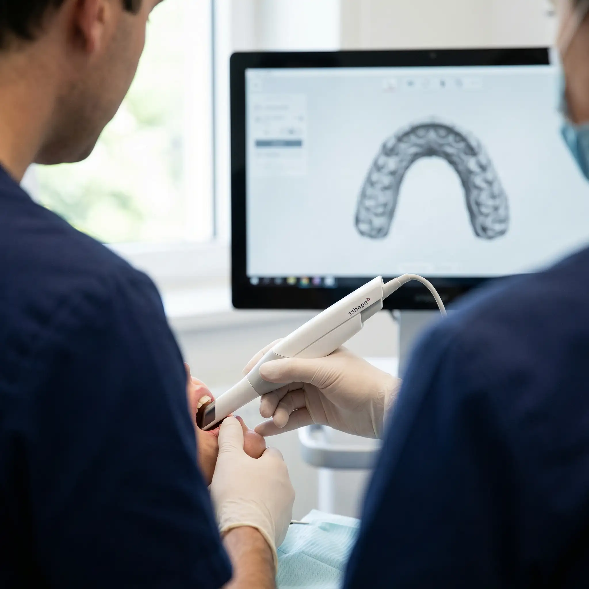Digital intraoral scanning