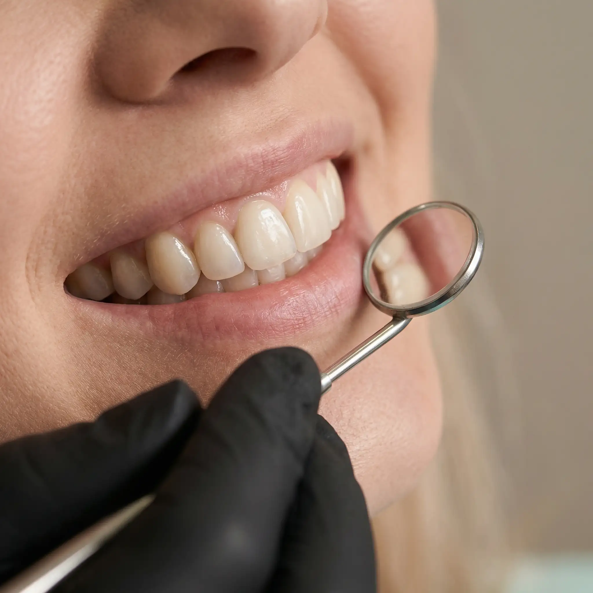 Professional dental examination